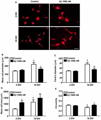 Key Aging-Associated Alterations in Primary Microglia Response to Beta-Amyloid Stimulation